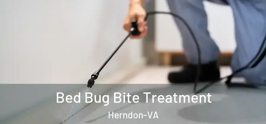  Bed Bug Bite Treatment Herndon-VA